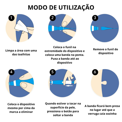 DermaPlus Kit - Removedor de Verrugas e Marcas da Pele